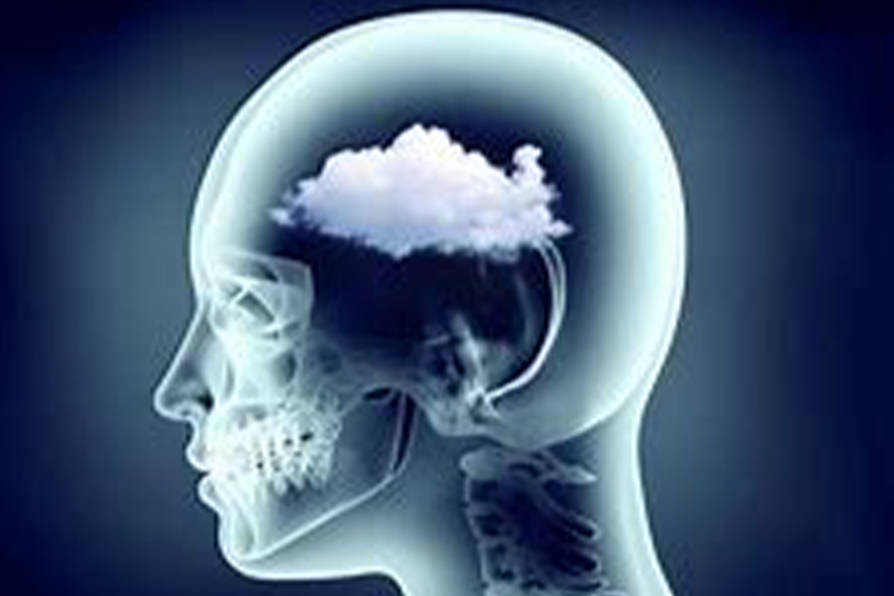 脑雾导致记性衰退？让它帮你补脑 