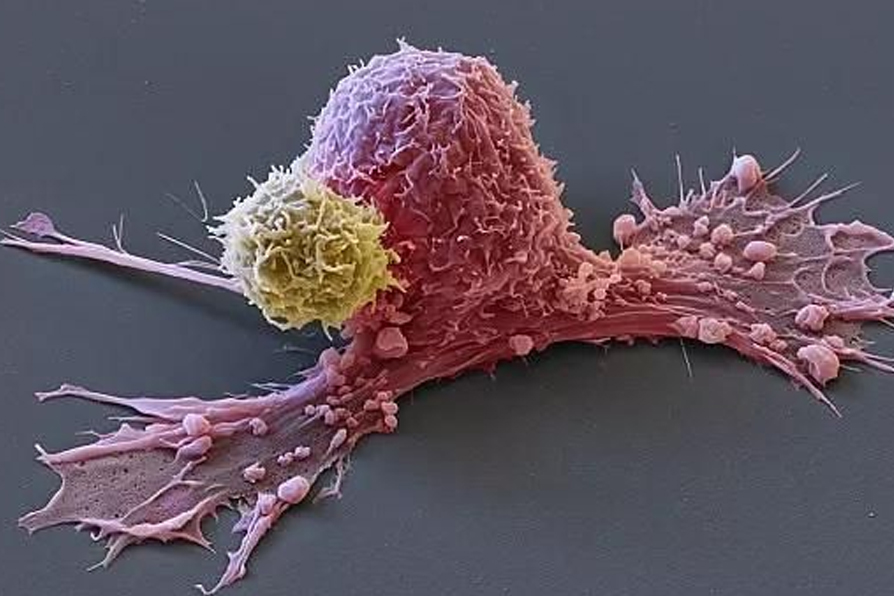 T细胞杀灭癌细胞.jpg
