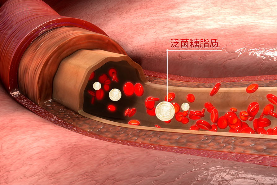 泛菌糖脂质清除血管异物.jpg